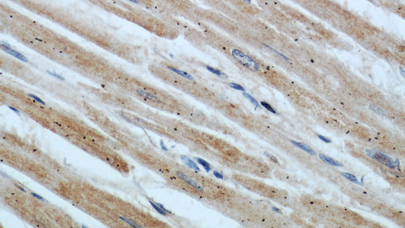 Immunohistochemical of paraffin-embedded human heart using Catalog No:107311(HADHA antibody) at dilution of 1:50 (under 40x lens)