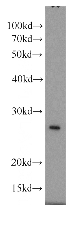mouse liver tissue were subjected to SDS PAGE followed by western blot with Catalog No:110860(GAMT antibody) at dilution of 1:6000