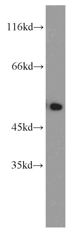 mouse brain tissue were subjected to SDS PAGE followed by western blot with Catalog No:110132(dynactin-2 antibody) at dilution of 1:800