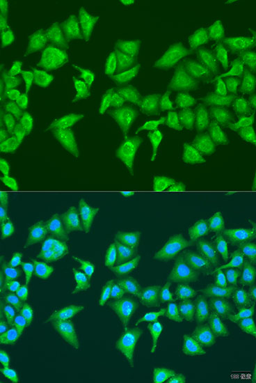 Immunofluorescence - HYLS1 Polyclonal Antibody 