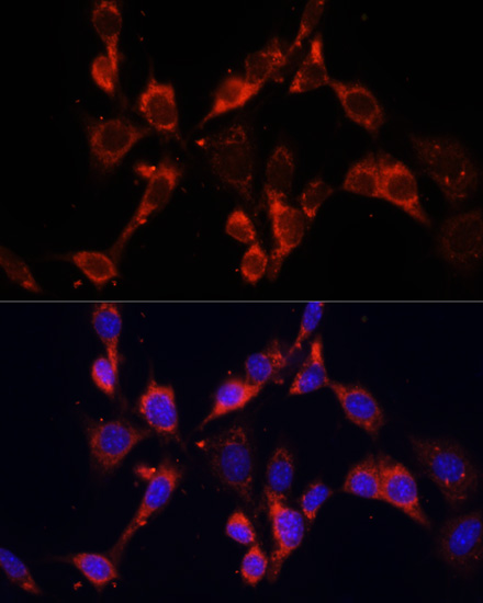 Immunofluorescence - DVL2 Polyclonal Antibody 