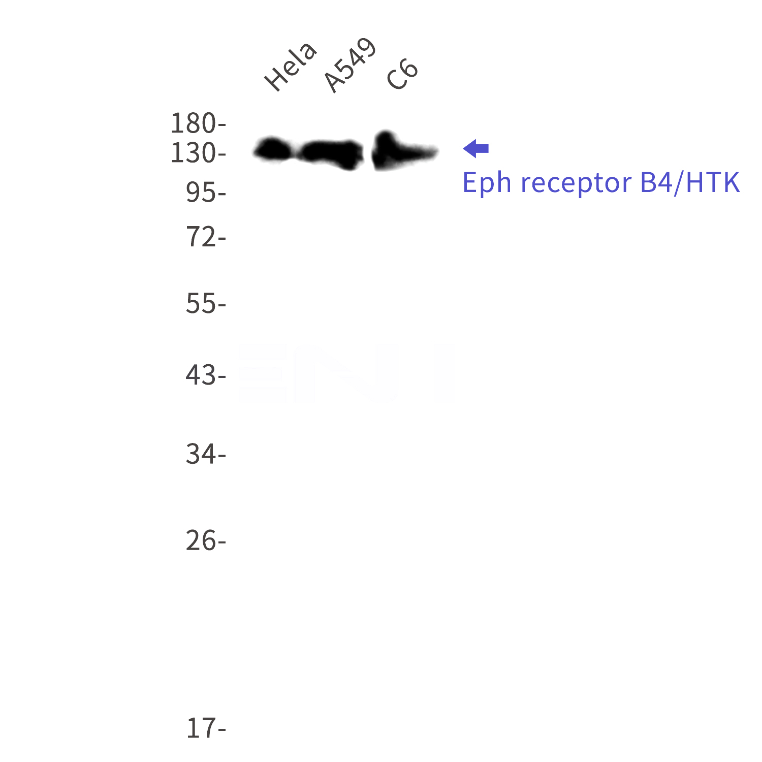 Western blot detection of Eph receptor B4/HTK in Hela,A549,C6 cell lysates using Eph receptor B4/HTK Rabbit mAb(1:1000 diluted).Predicted band size:108kDa.Observed band size:135kDa.