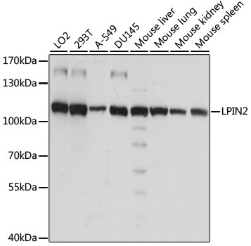 Western blot - LPIN2 Polyclonal Antibody 