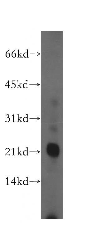 human liver tissue were subjected to SDS PAGE followed by western blot with Catalog No:108996(CCK antibody) at dilution of 1:500