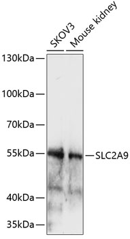 Western blot - SLC2A9 Polyclonal Antibody 