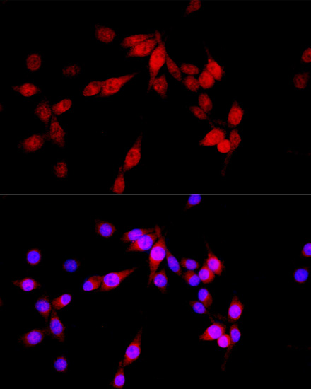 Immunofluorescence - ASPSCR1 Polyclonal Antibody 