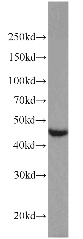 Jurkat cells were subjected to SDS PAGE followed by western blot with Catalog No:110303(LPAR1,EDG2 antibody) at dilution of 1:1000