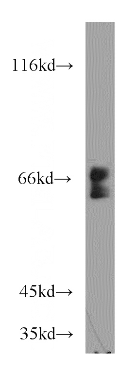 mouse heart tissue were subjected to SDS PAGE followed by western blot with Catalog No:116667(UBXN4 antibody) at dilution of 1:500