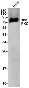 Western blot detection of PKC in Hela cell lysates using PKC Rabbit pAb(1:1000 diluted).Predicted band size:78KDa.Observed band size:78KDa.