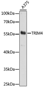 Western blot - TRIM4 Polyclonal Antibody 