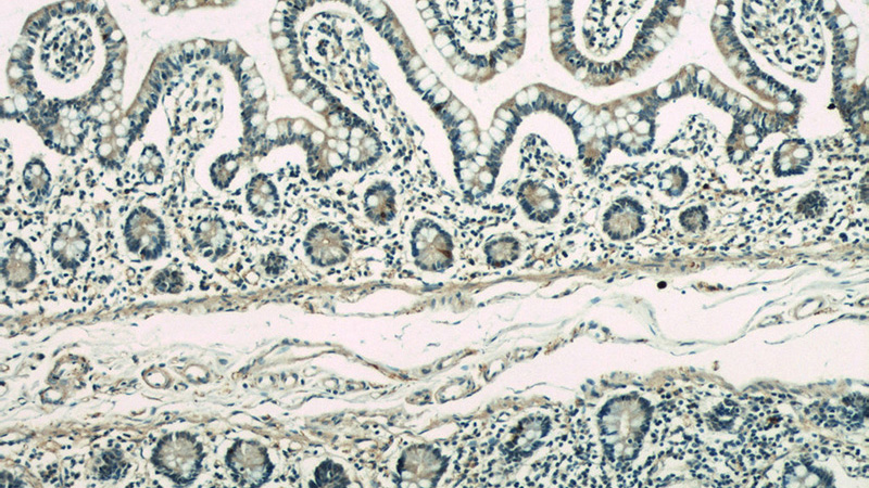 Immunohistochemical of paraffin-embedded human small intestine using Catalog No:112232(Lin28A-specific antibody) at dilution of 1:50 (under 10x lens)