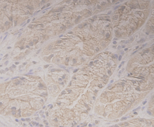 Fig8: Immunohistochemical analysis of paraffin-embedded human stamoch tissue using anti-GRAMD1A antibody. Counter stained with hematoxylin.