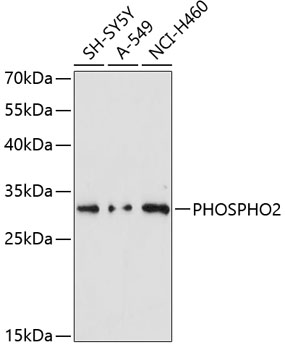 Western blot - PHOSPHO2 Polyclonal Antibody 