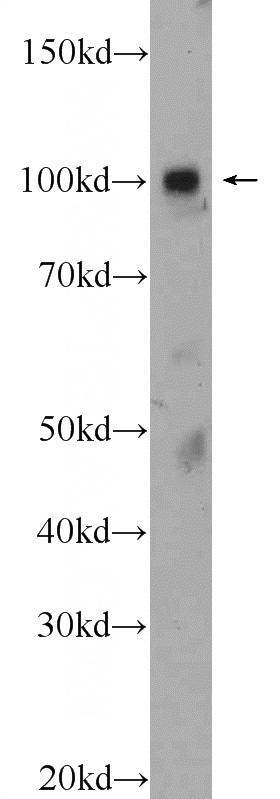 fetal human brain tissue were subjected to SDS PAGE followed by western blot with Catalog No:117182(ZNF483 Antibody) at dilution of 1:300