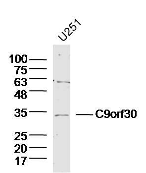 Fig2: Sample:U251 Cell (Human) Lysate at 40 ug; Primary: Anti-C9orf30 at 1/300 dilution; Secondary: IRDye800CW Goat Anti-Rabbit IgG at 1/20000 dilution; Predicted band size: 32kD; Observed band size: 32kD
