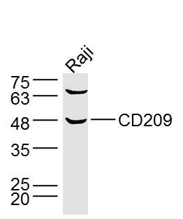 Fig1: Sample:Raji Cell (Human) Lysate at 40 ug; Primary: Anti-CD209 at 1/300 dilution; Secondary: IRDye800CW Goat Anti-Rabbit IgG at 1/20000 dilution; Predicted band size: 45kD; Observed band size: 47kD