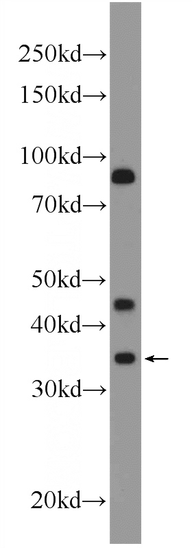 mouse liver tissue were subjected to SDS PAGE followed by western blot with Catalog No:110390(EPO Antibody) at dilution of 1:300