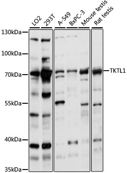 Western blot - TKTL1 Polyclonal Antibody 