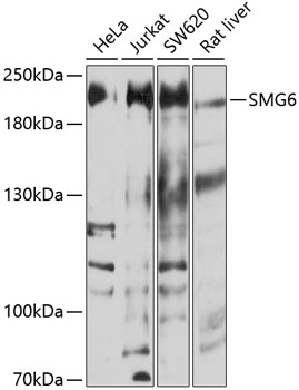 Western blot - SMG6 Polyclonal Antibody 
