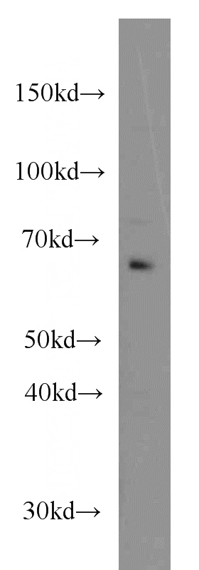 HeLa cells were subjected to SDS PAGE followed by western blot with Catalog No:107145(CDC6 antibody) at dilution of 1:500