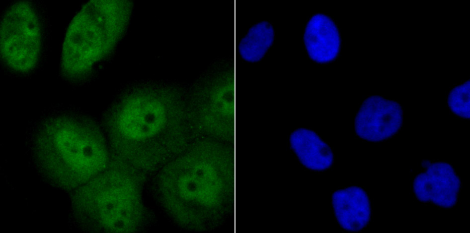 Fig2: ICC staining Tle6 in A431 cells (green). The nuclear counter stain is DAPI (blue). Cells were fixed in paraformaldehyde, permeabilised with 0.25% Triton X100/PBS.