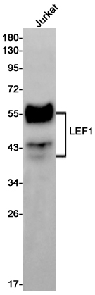 Western blot detection of LEF1 in Jurkat cell lysates using LEF1 Rabbit mAb(1:1000 diluted).Predicted band size:44kDa.Observed band size:25-58kDa.