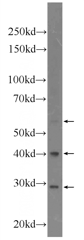 HeLa cells were subjected to SDS PAGE followed by western blot with Catalog No:112951(NARFL Antibody) at dilution of 1:300