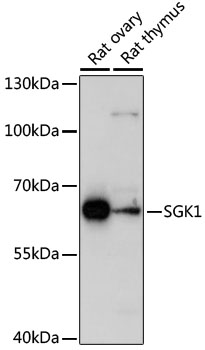 Western blot - SGK1 Polyclonal Antibody 