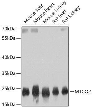 Western blot - MTCO2 Polyclonal Antibody 