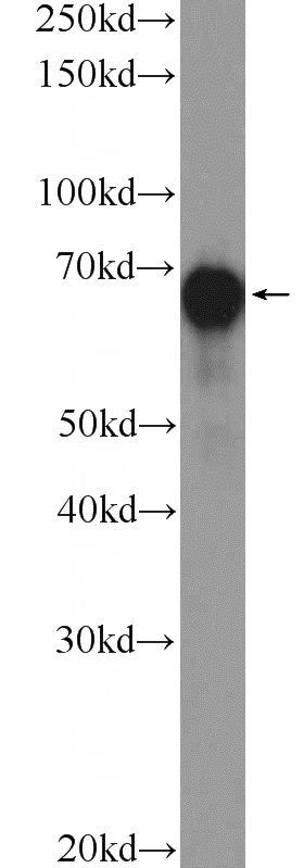 HeLa cells were subjected to SDS PAGE followed by western blot with Catalog No:116880(YAP1 Antibody) at dilution of 1:1000