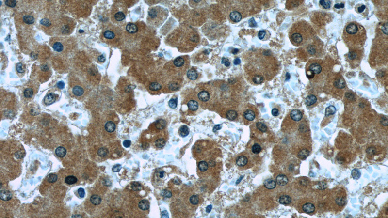 Immunohistochemistry of paraffin-embedded human liver slide using Catalog No:107165(CLU Antibody) at dilution of 1:50 (under 40x lens)