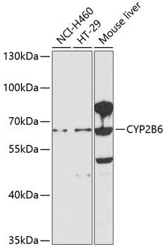 Western blot - CYP2B6 Polyclonal Antibody 