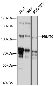 Western blot - PRMT9 Polyclonal Antibody 