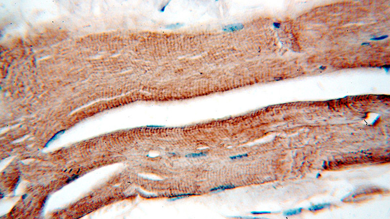 Immunohistochemical of paraffin-embedded human skeletal muscle using Catalog No:109958(DNASE1L1 antibody) at dilution of 1:50 (under 40x lens)