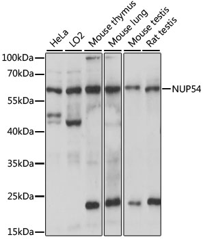 Western blot - NUP54 Polyclonal Antibody 