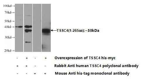 Transfected HEK-293 cells were subjected to SDS PAGE followed by western blot with Catalog No:116372(TSSC4 Antibody) at dilution of 1:1000