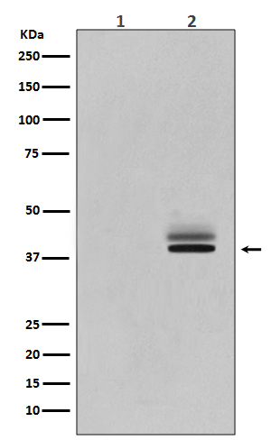 Western blot analysis of Phospho-Erk1 (T202/Y204) + Erk2 (T185/Y187) expression in A431 cell lysate treated with EGF.
