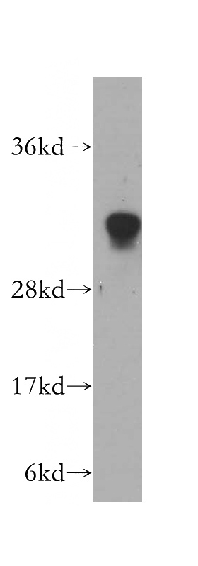 human heart tissue were subjected to SDS PAGE followed by western blot with Catalog No:111278(HCCS antibody) at dilution of 1:500