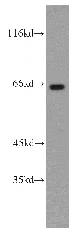 Y79 cells were subjected to SDS PAGE followed by western blot with Catalog No:109589(CRY2 antibody) at dilution of 1:1000