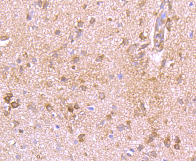 Fig4: Immunohistochemical analysis of paraffin-embedded rat brain tissue using anti-Kv1.4 antibody. Counter stained with hematoxylin.