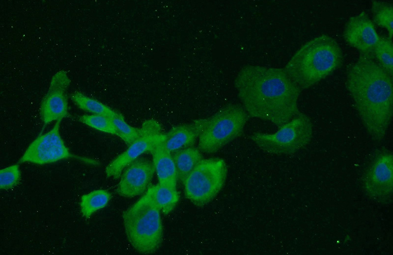 Immunofluorescent analysis of A431 cells using Catalog No:107342(NUMB Antibody) at dilution of 1:50 and Alexa Fluor 488-congugated AffiniPure Goat Anti-Mouse IgG(H+L)