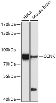 Western blot - CCNK Polyclonal Antibody 