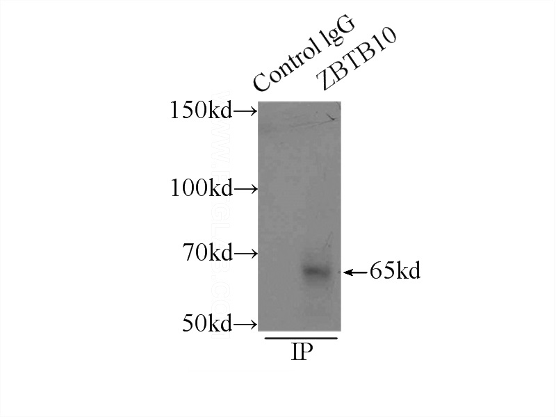 IP Result of anti-ZBTB10 (IP:Catalog No:116908, 3ug; Detection:Catalog No:116908 1:1000) with mouse liver tissue lysate 12500ug.