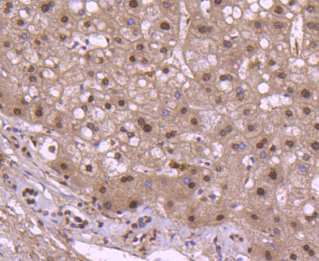 Fig4:; Immunohistochemical analysis of paraffin-embedded human liver tissue using anti-Histone H2B antibody. The section was pre-treated using heat mediated antigen retrieval with Tris-EDTA buffer (pH 8.0-8.4) for 20 minutes.The tissues were blocked in 5% BSA for 30 minutes at room temperature, washed with ddH; 2; O and PBS, and then probed with the primary antibody ( 1/50) for 30 minutes at room temperature. The detection was performed using an HRP conjugated compact polymer system. DAB was used as the chromogen. Tissues were counterstained with hematoxylin and mounted with DPX.