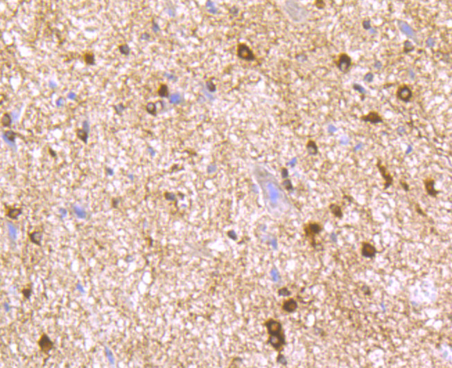Fig2: Immunohistochemical analysis of paraffin-embedded rat spinal cord tissue using anti-LNP antibody. Counter stained with hematoxylin.