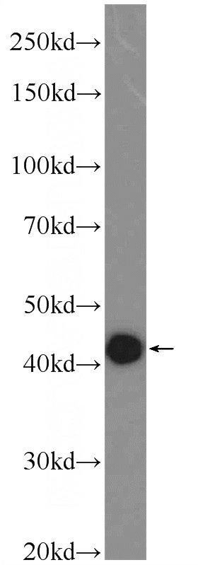 A549 cells were subjected to SDS PAGE followed by western blot with Catalog No:114723(RMND5B Antibody) at dilution of 1:600