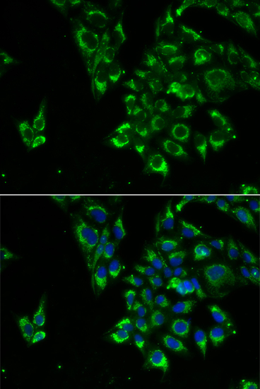Immunofluorescence - TSHB Polyclonal Antibody 