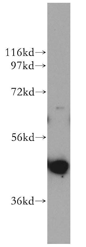 mouse testis tissue were subjected to SDS PAGE followed by western blot with Catalog No:113785(PGK2 antibody) at dilution of 1:1200