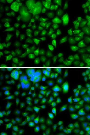 Immunofluorescence - METTL7B Polyclonal Antibody 