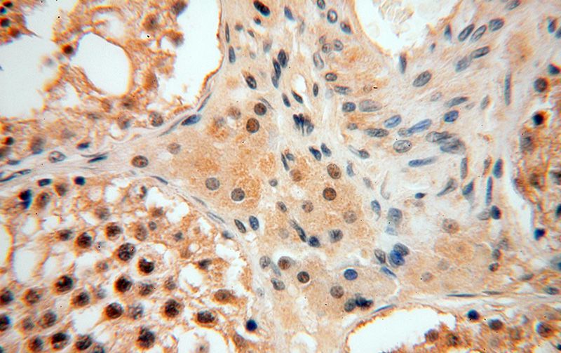 Immunohistochemical of paraffin-embedded human testis using Catalog No:114135(PPM1G antibody) at dilution of 1:100 (under 40x lens)